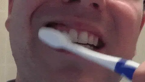 Dientes amarillentos? - Silvia Olmedo