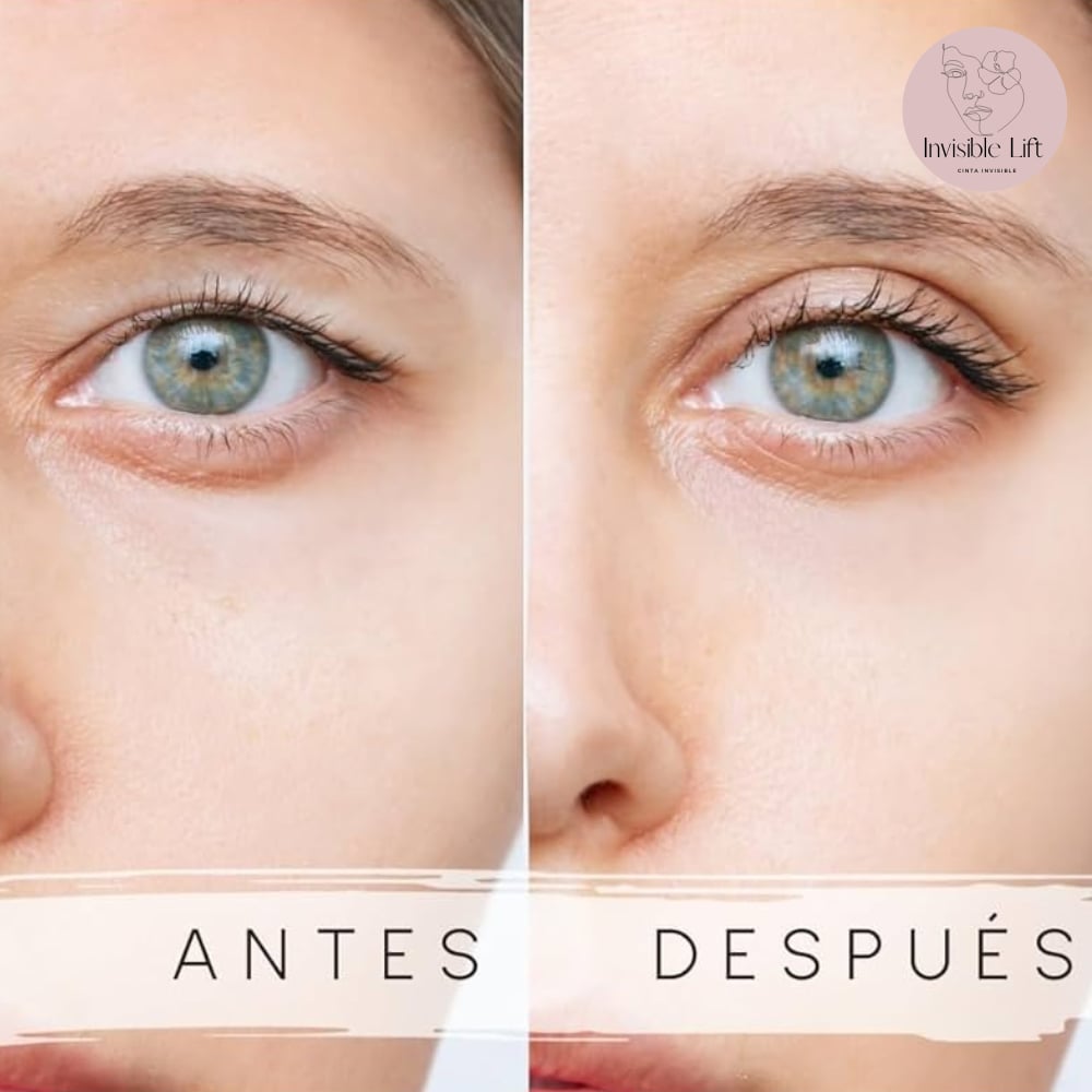 Cinta invisible levanta parpados INVISIBLE LIFT™ – SevenMarket