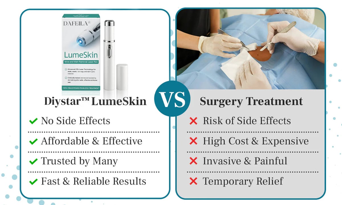 Lápiz láser para eliminar lunares y verrugas DIYSTAR™ LumeSkin