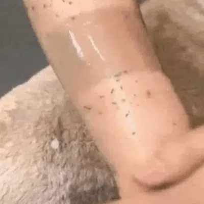 Aplicación del gel