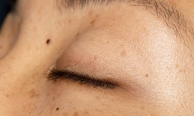 Cuidado para la apariencia del contorno de ojos