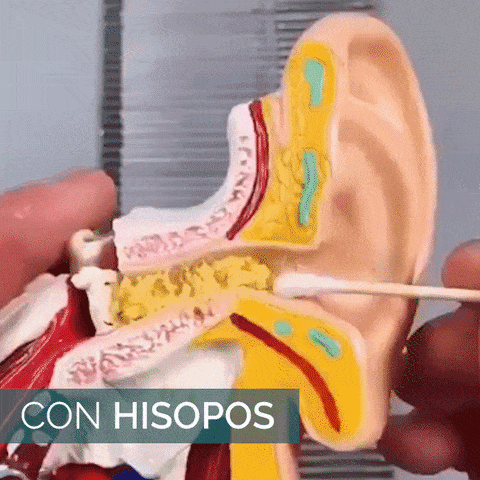KIT LIMPIADOR DE OIDOS 👂 – La Iguana Shop