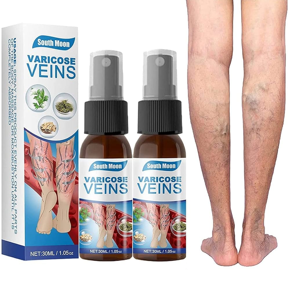 Spray de tratamento de varizes para cicatrização de veias 2 peças, spray de tratamento de varizes de veias, tratamento de varizes para pernas, varizes spray milagroso, melhora a circulação sanguínea | Amazon.com.br