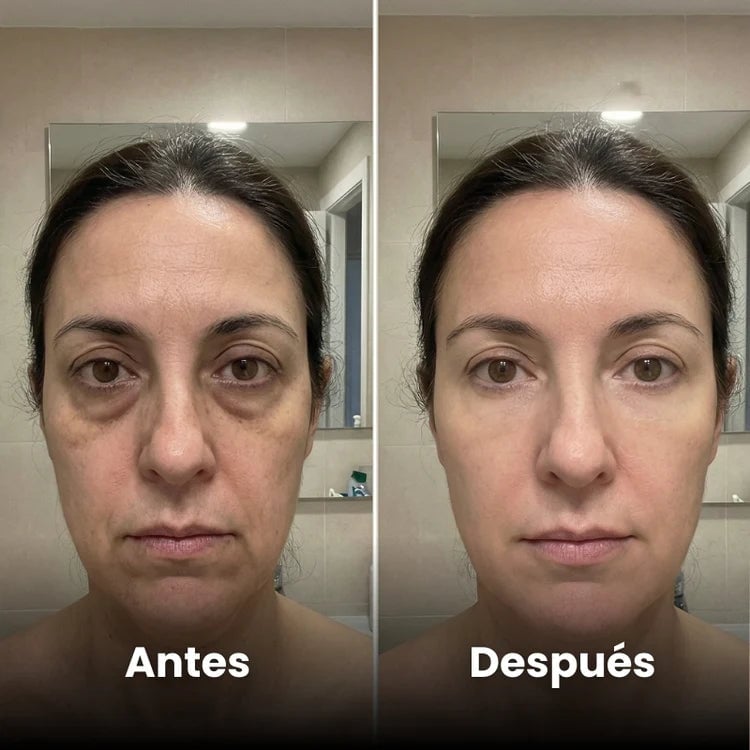 Ojeras