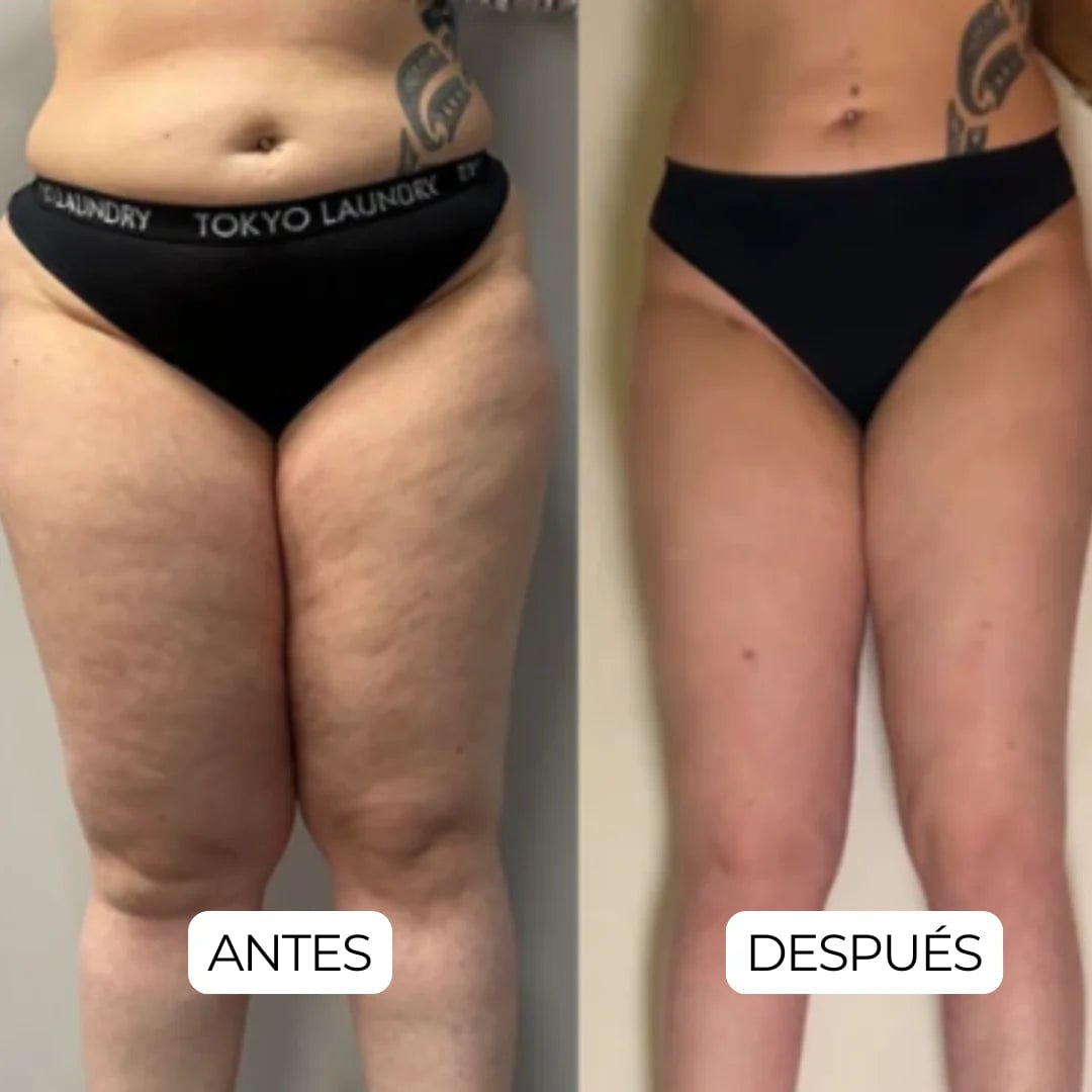 Testimonio cliente