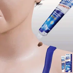 Wart Remover© – Instant Spot Treatment Cream | W i z z g o o