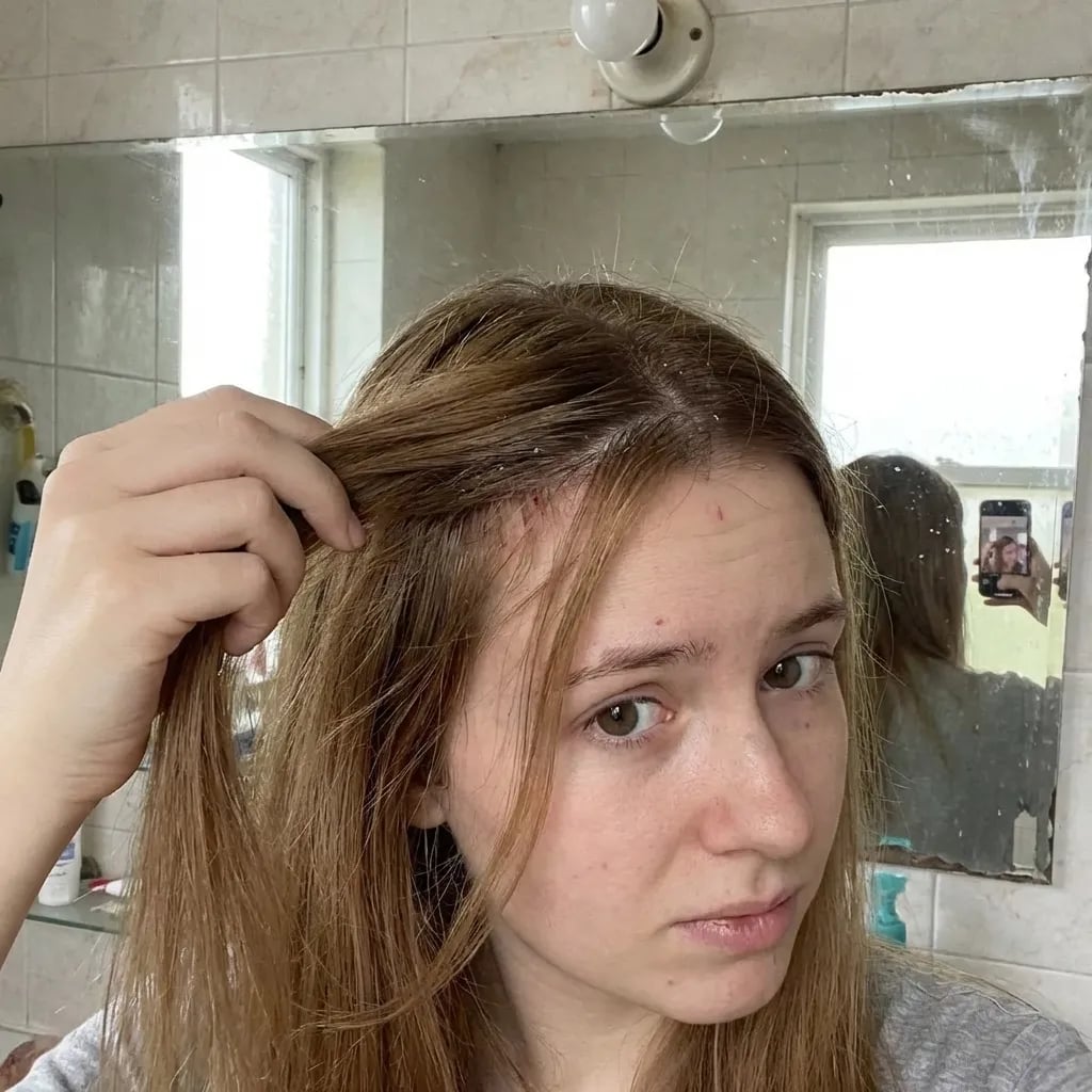 Antes