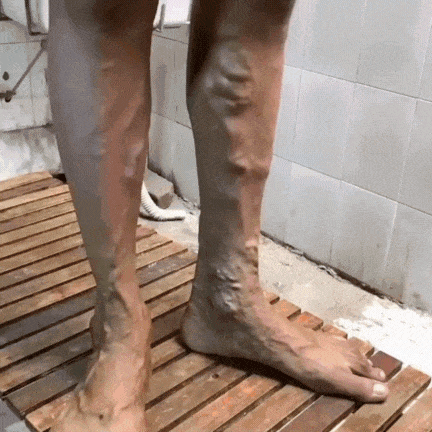 SS Herbal Varicose Vein Spray - Instant Relief & Vein Care Solution! 👨 – Shoppr Store