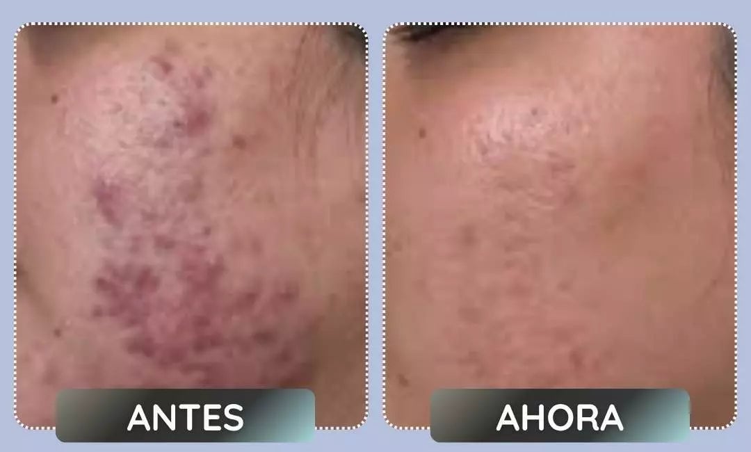 Detalle producto