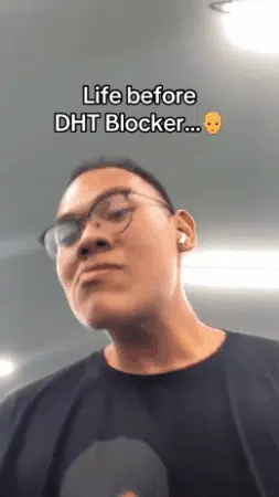 Beneficios del DHT Blocker