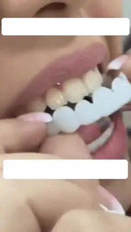 Sonriplus™ 😁💎 – Devuelve a tu sonrisa un aspecto natural y radiante al instante 🌟🦷