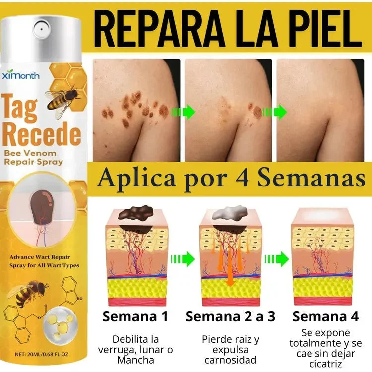 ELIMINADOR DE VERRUGAS TAG RECEDE