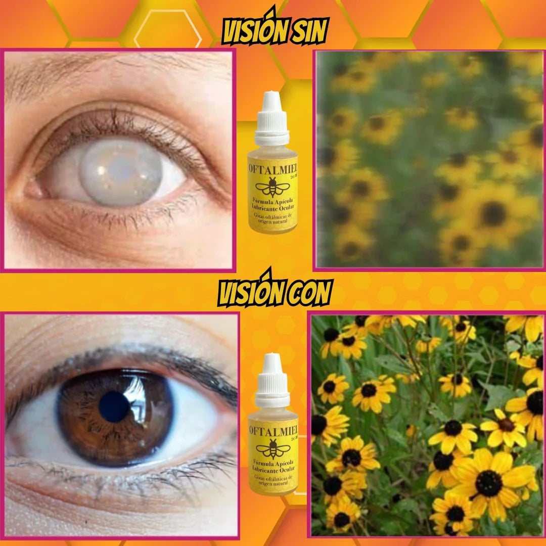 OFTALMIEL™🐝 Alivio y frescura para tus ojos + ENVÍO GRATIS 🎁