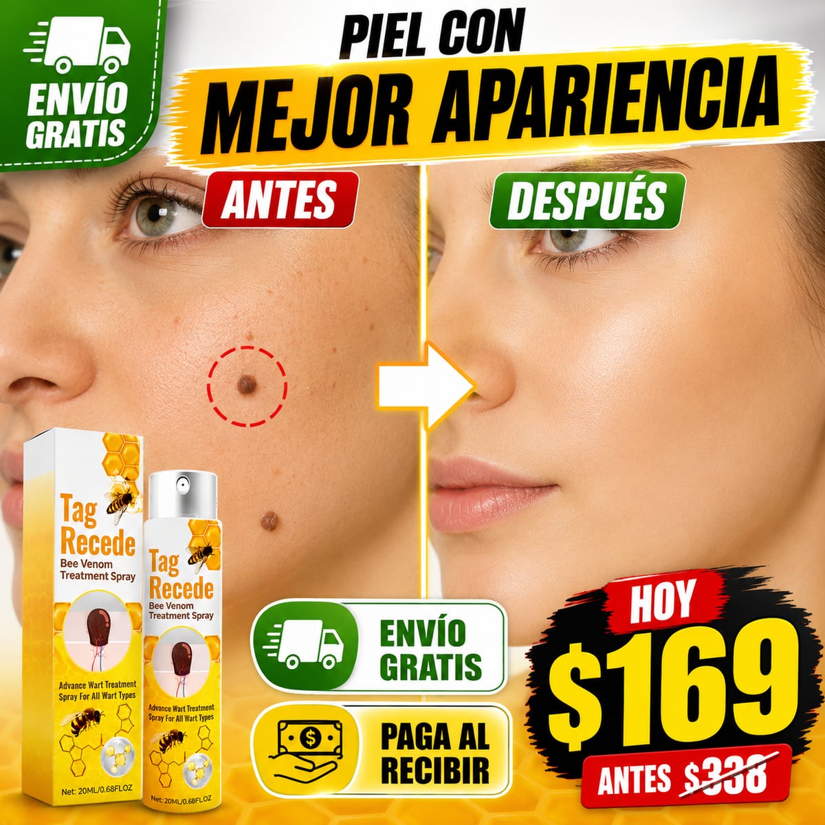 Adiós A Las Verrugas TAG RECEDE + Envio Gratis 🎁