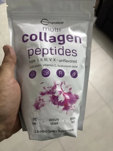 Foto de Patricia Aguilar