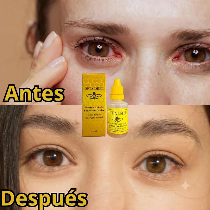 OftalMiel-El Poder de la Miel Para la Restauracion Visual