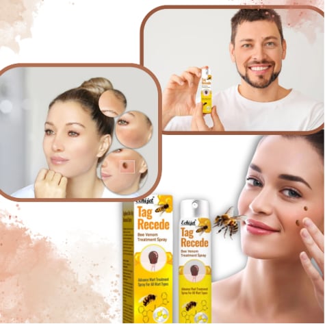 Spray BeeVenom™ para Verrugas y de Cuidado Localizado para la Piel