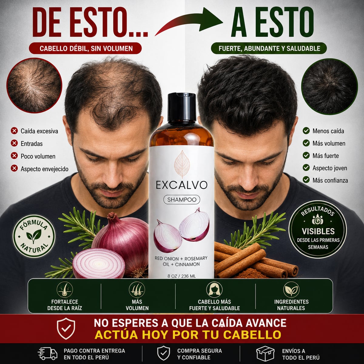 SHAMPOO CRECIMIENTO CAPILAR  - EXCALVO