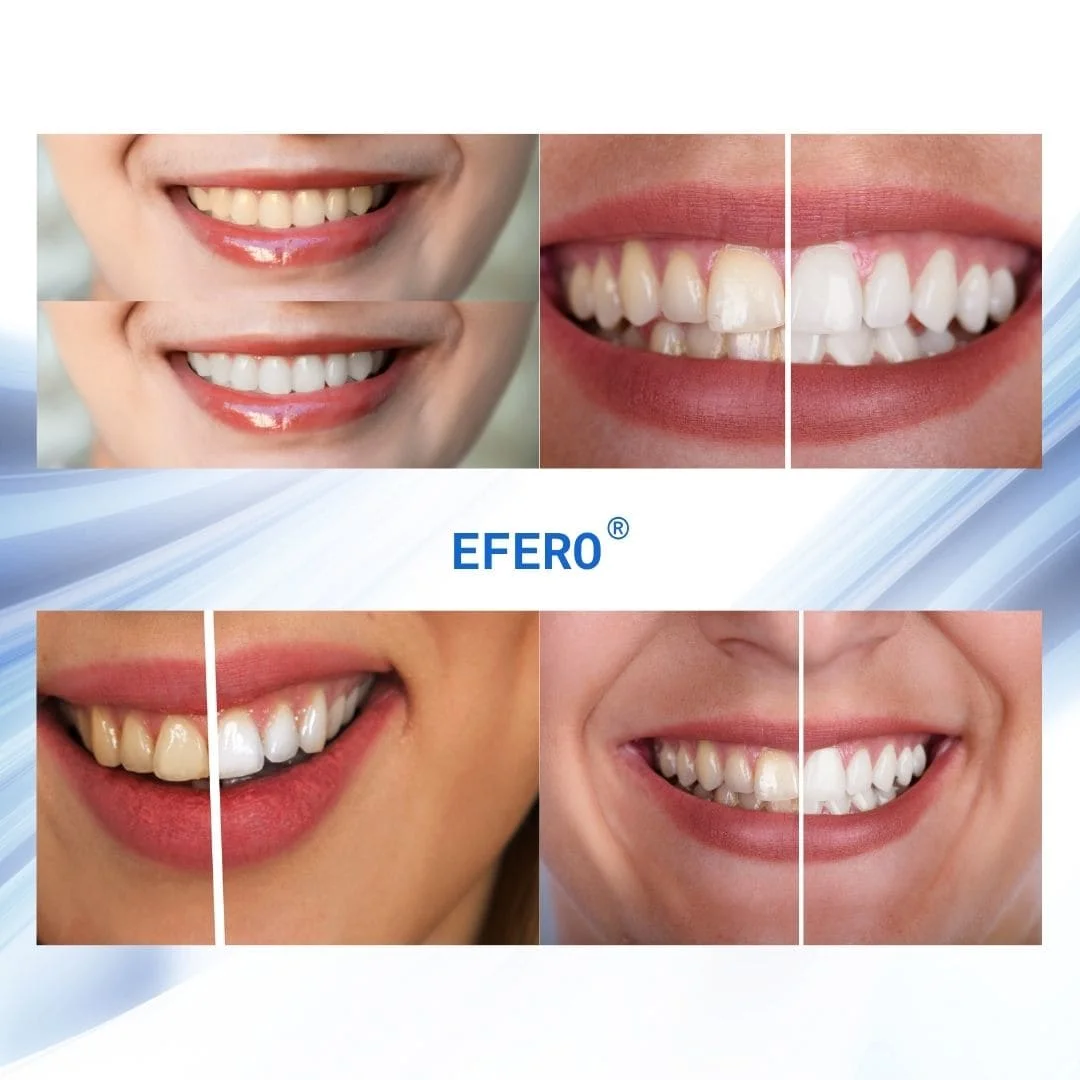 EFERO® (Lápiz blanqueador dental)