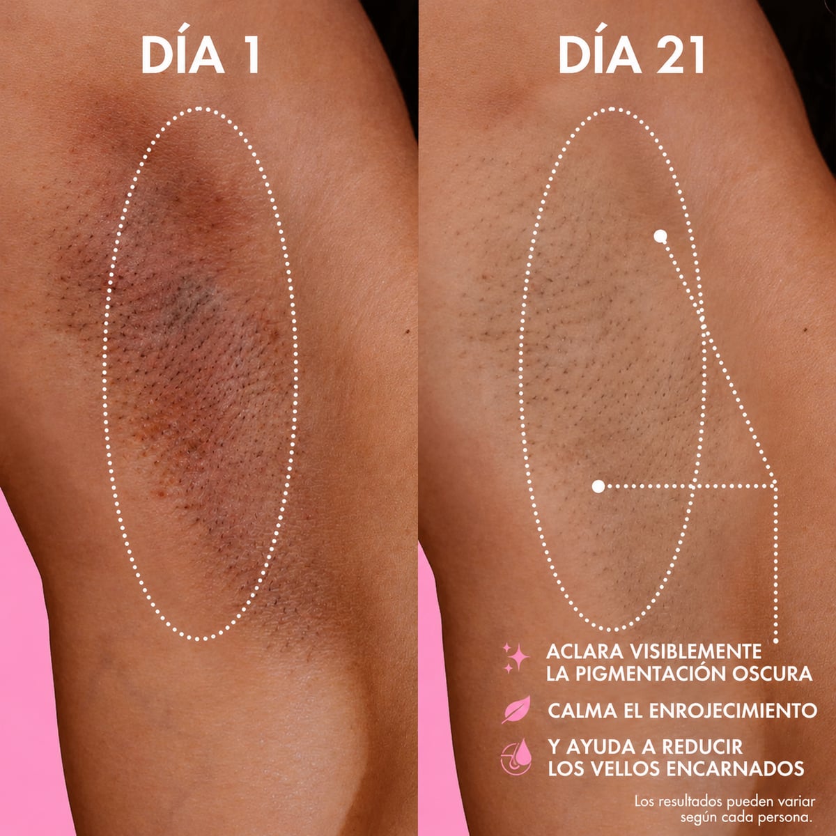 🏵️ ACEITE TRULY™ Cuidado Aclarante con Hidratación Profunda