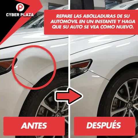 2x1 Ventosa extractor de Abolladuras para Vehículos + Envío Gratis y Regalo 🎁