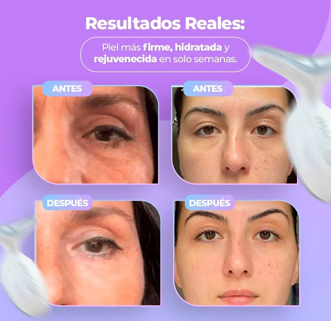Masajeador Facial - Terapia de Luz Facial Antienvejecimiento