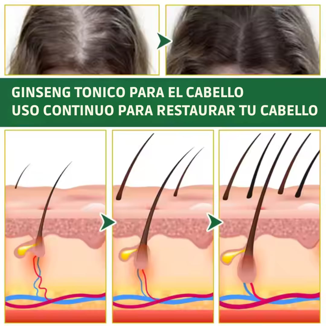 Tónico Capilar OUHOE Para la Caída del Cabello