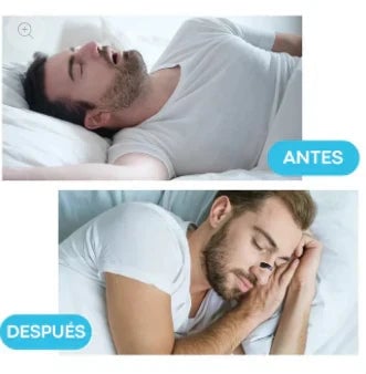 AirZen™ Kit 4 dilatadores nasales + 30 parches magnéticos