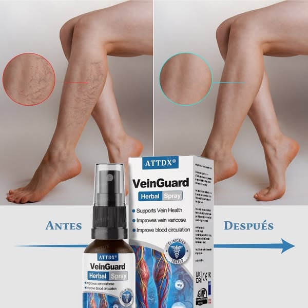 🩺 Varicose Veins™ Pro Tratamiento Intensivo Avanzado para Venas, Varices y Piernas Cansadas (Oferta 2x1)