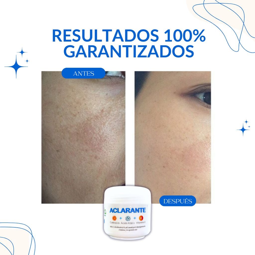 CREMA ACLARANTE🌸- LA MAS EFECTIVA DEL MERCADO + ENVIO GRATIS🚚