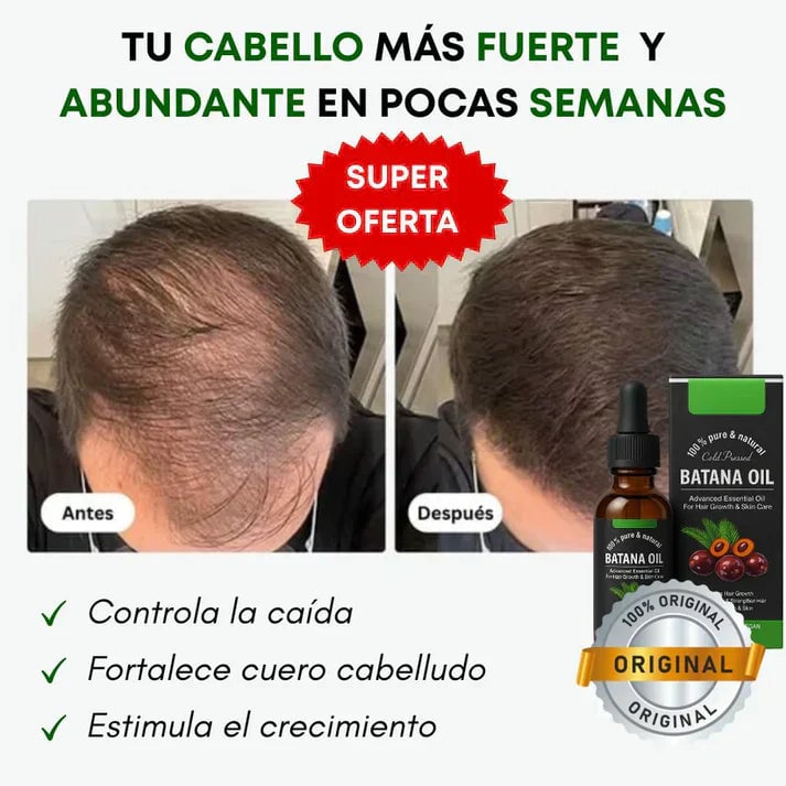 Aceite de Batana®:Crecimiento capilar, Da brillo, hidrata y fortalece | Envío Gratis 🎁