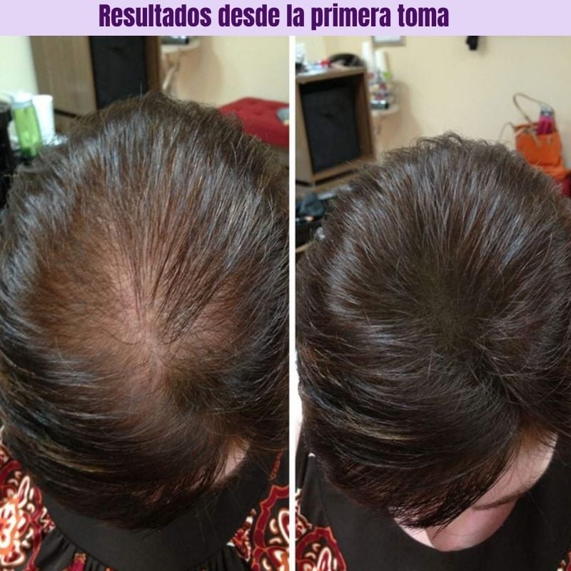 HairGrowth™: Suplemento para el crecimiento capilar avanzado