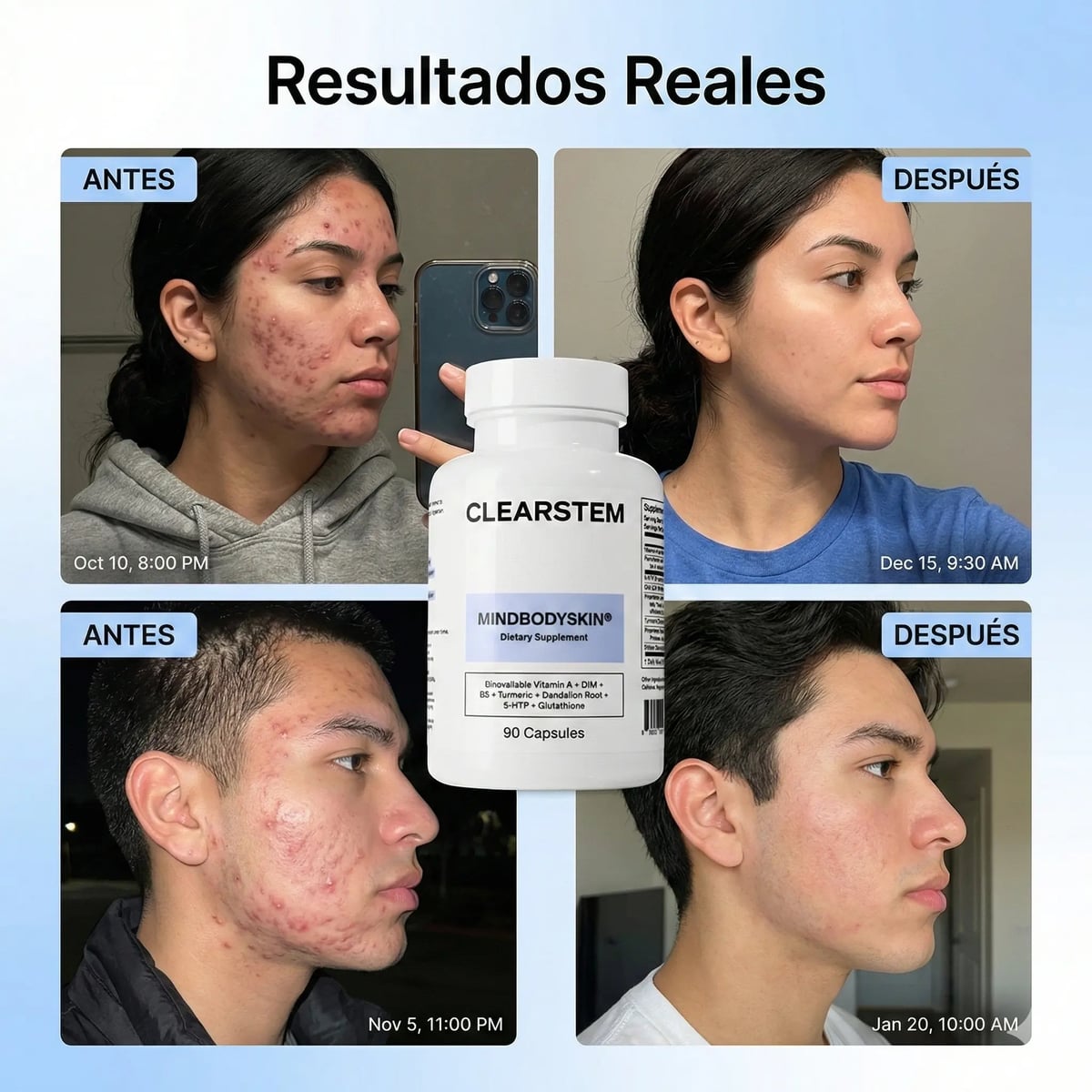 MINDBODYSKIN Clearstem - Acaba con el Acné Hormonal en 7 Días.