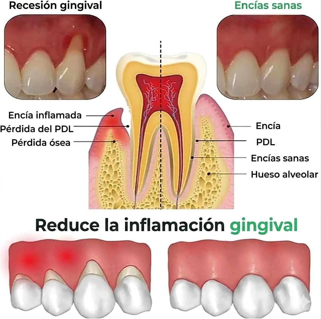 ULTIMAS UNIDADES - REPARA CARIES, ALIVIA ENCÍAS INFLAMADAS + ENVÍO GRATIS