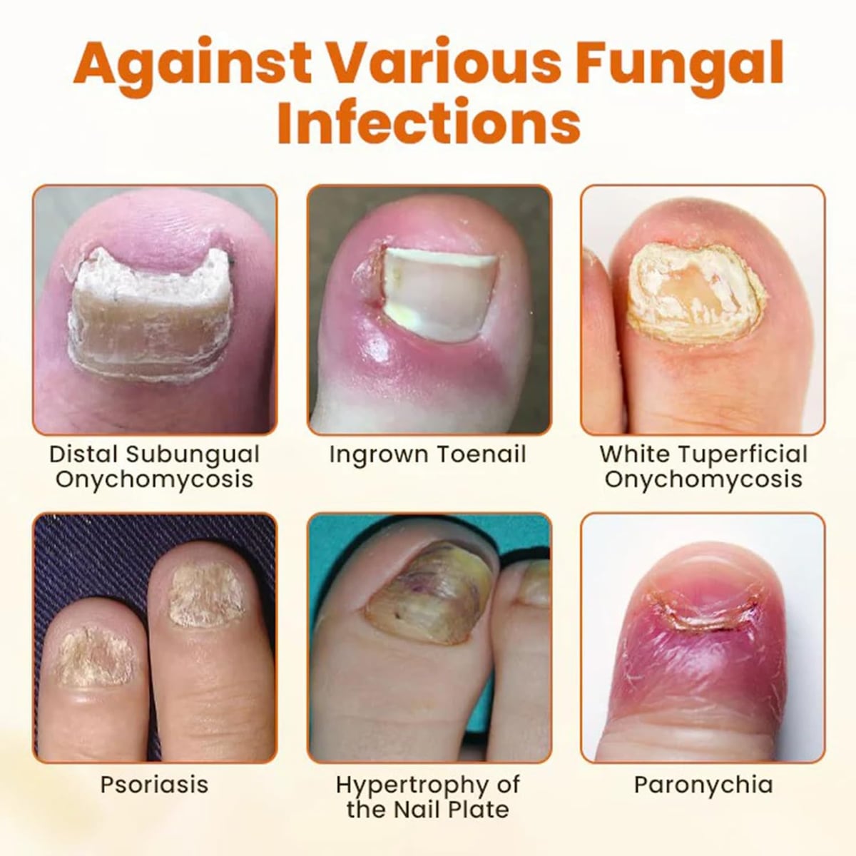 FungiBee Reparador de Uñas