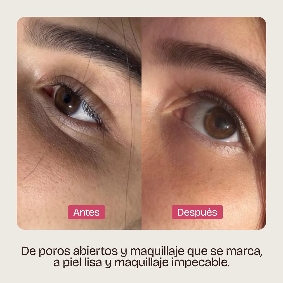 GEL DE RECUBRIMIENTO