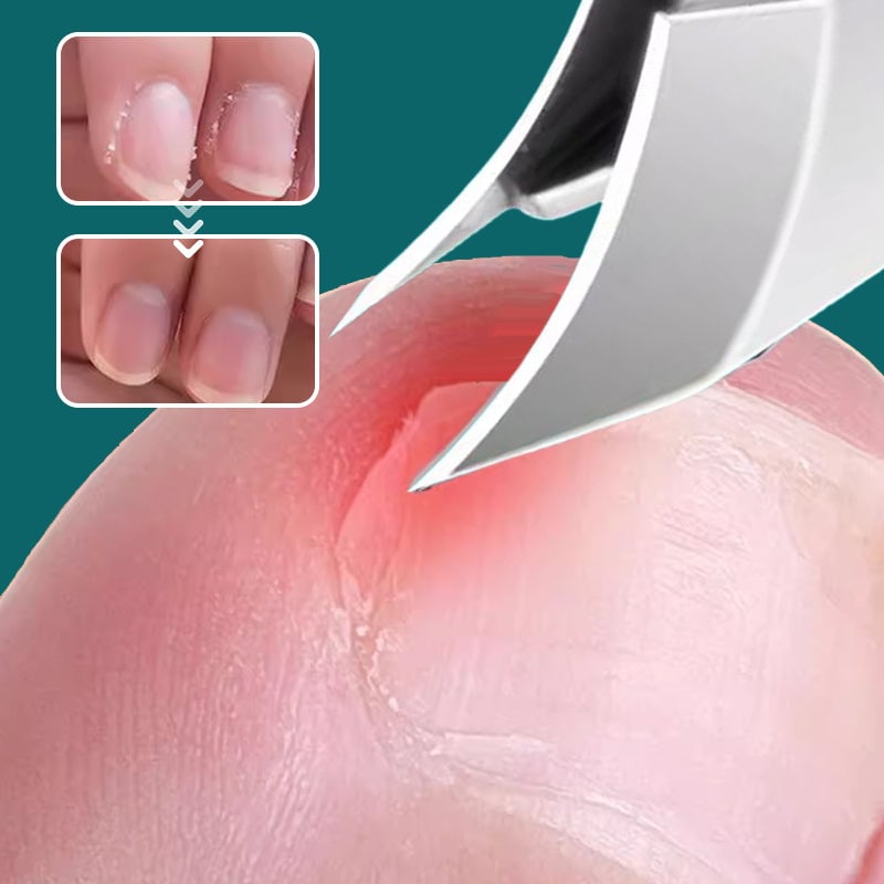 🔥Oferta 2026🔥 Cortaúñas anti-uñero con borde inclinado de 25°
