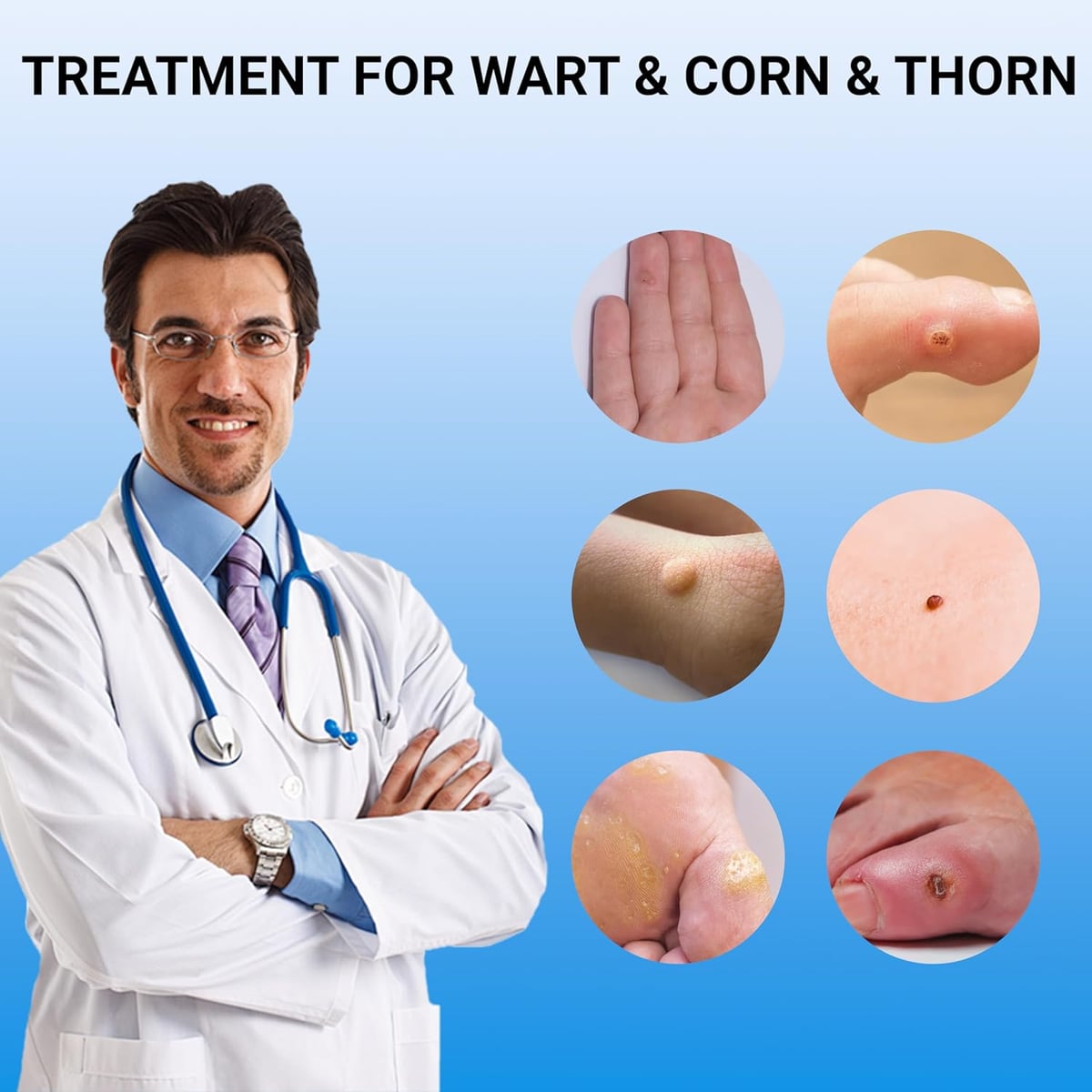 WART REMOVER