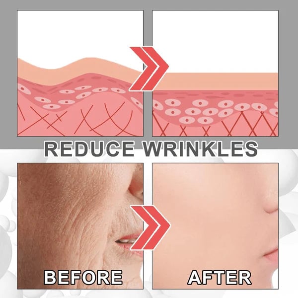 Eelhoe Suero Facial Avanzado con Colágeno