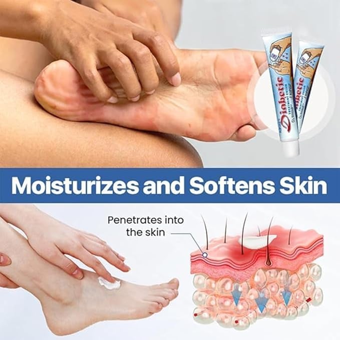 Crema Reparadora para Pies Diabéticos + ENVIO GRATIS