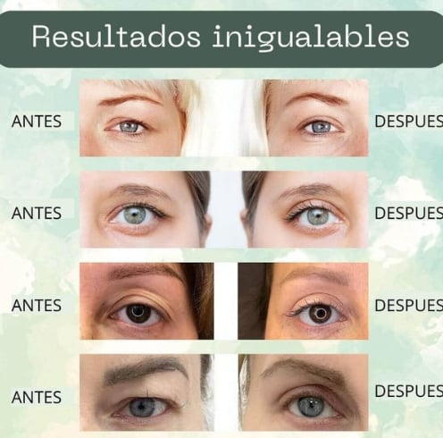Cintas Levanta Párpados: 480 Unidades