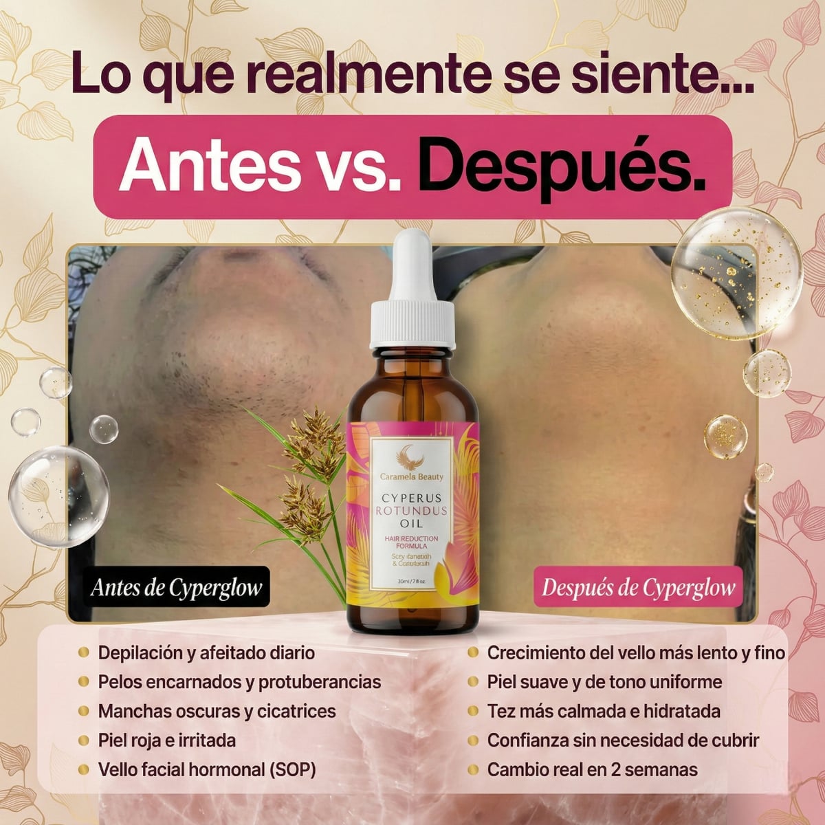 Aceite de Cyperus Rotundus para el Cuidado Corporal