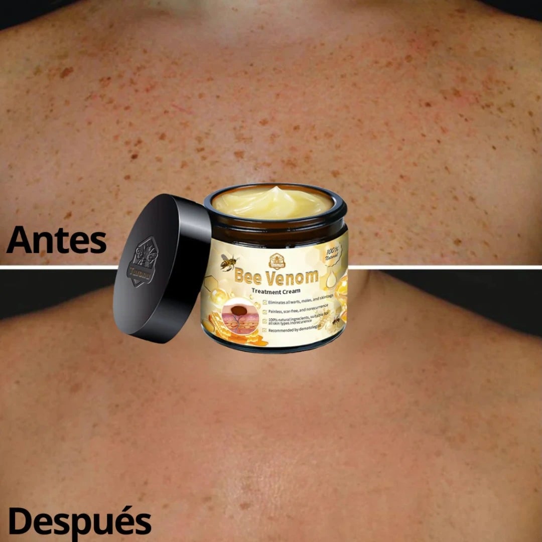 Crema premium BEE VENOM-QUITA VERRUGA Y TAGS DE PIEL🐝