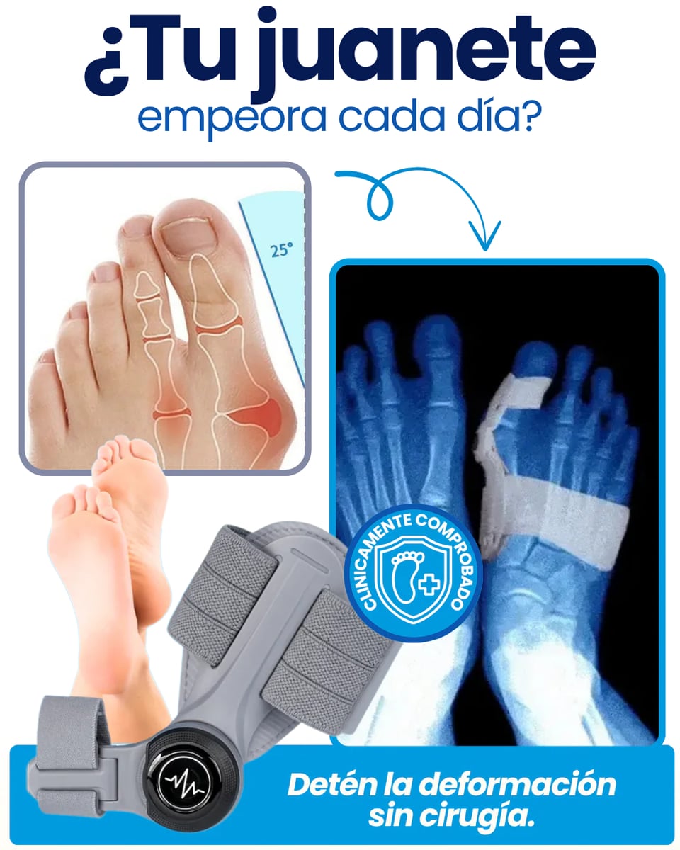 Corrector de Juanetes / Adiós a los juanetes en solo días