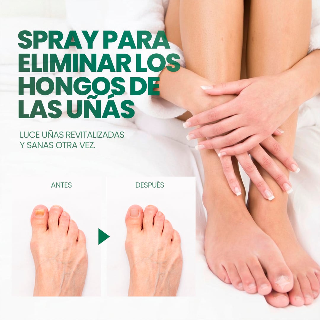 La fórmula en spray que atraviesa la uña y elimina el hongo desde la raíz
