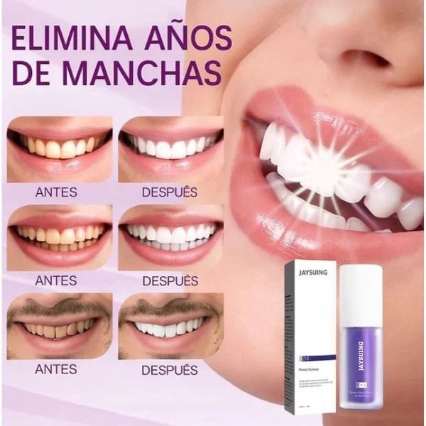 WhiteLuxe™ Transforma tu sonrisa con frescura – Whitening Formula® Oferta 2 x 1