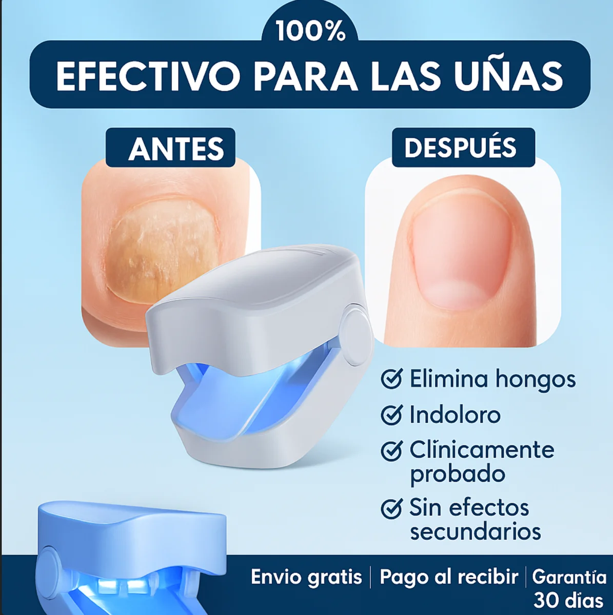 Laser Para Quitar Hongos De Las Uñas. (Onicomicosis Láser)®