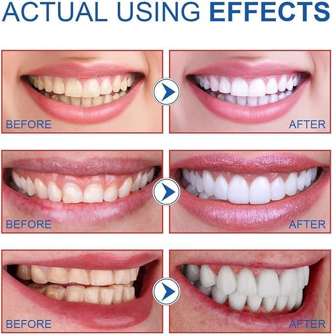 Gel Dental para Manchas y Sonrisa Luminosa Blue Chic SP-4