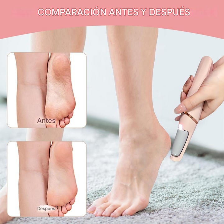 ULTIMAS UNIDADES ✨PediLuxe® - Quita Callos Eléctrico👣 + ENVÍO GRATIS