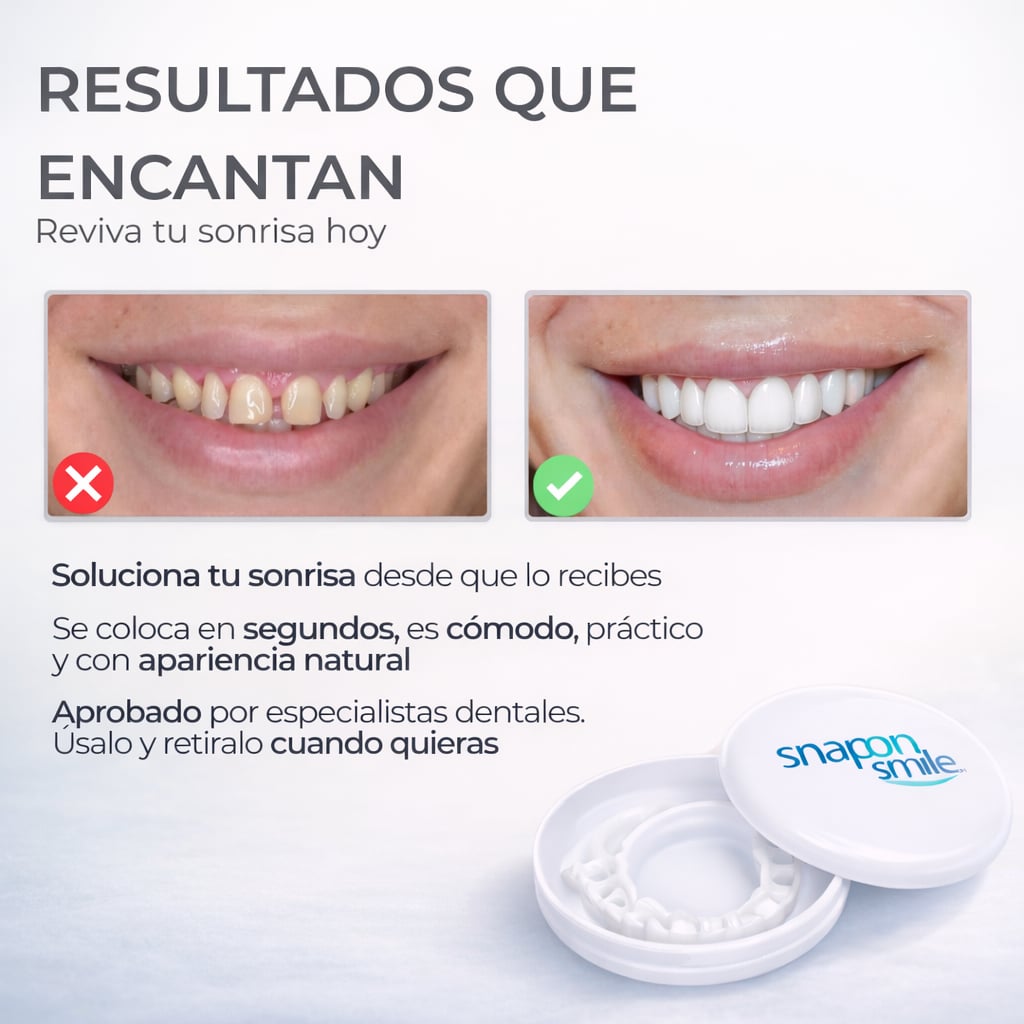 Snap Smile- Carillas dentales removibles
